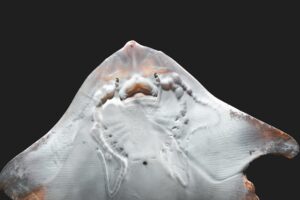 Calcium Needs During Pregnancy Supporting Fetal Development and Maternal Bone Strength