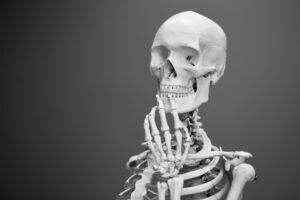 Understanding the Link Between Calcium Intake and Kidney Stone Formation Risks